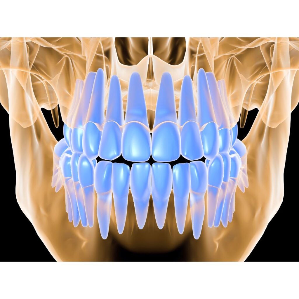 和光市　歯医者　和光市デンタルオフィス　骨粗鬆症と歯科治療