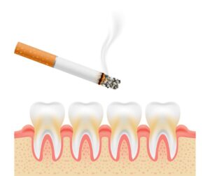 和光市　歯医者　和光市デンタルオフィス　たばこが口腔内に与える影響
